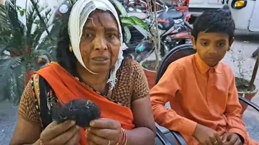 महिला के बाल लोचे 