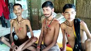 rewa,Five members ,same family ,muscular dystrophy