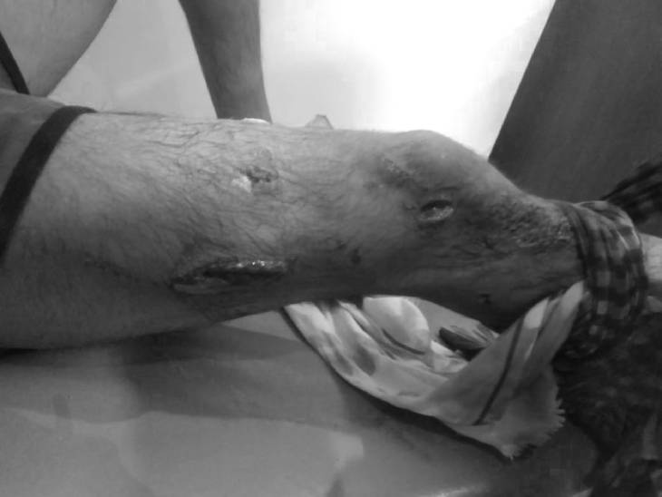  युवक पर जानलेवा हमला 