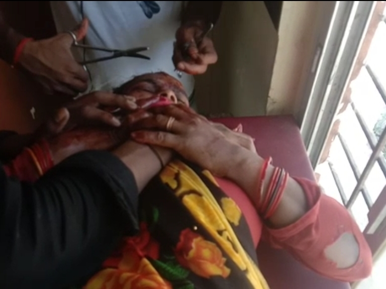  वारदात के बाद बदमाश मौके से भाग निकले