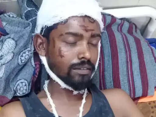  गंभीर रूप से घायल निलेश को जिला अस्पताल में भर्ती करवाया गया