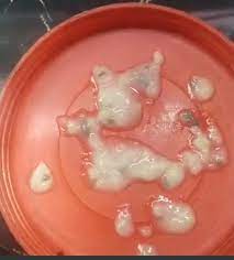 rajgarh, Health of children ,Anganwadi center