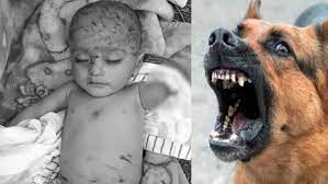 bhopal, Seven month old innocent , bloody condition