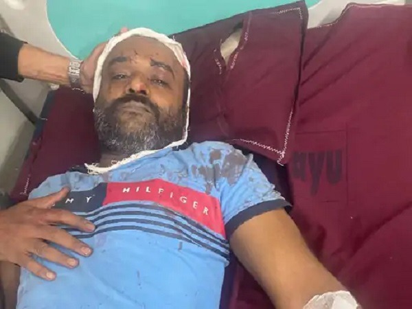 bhopal, Miscreants shot , property dealer 