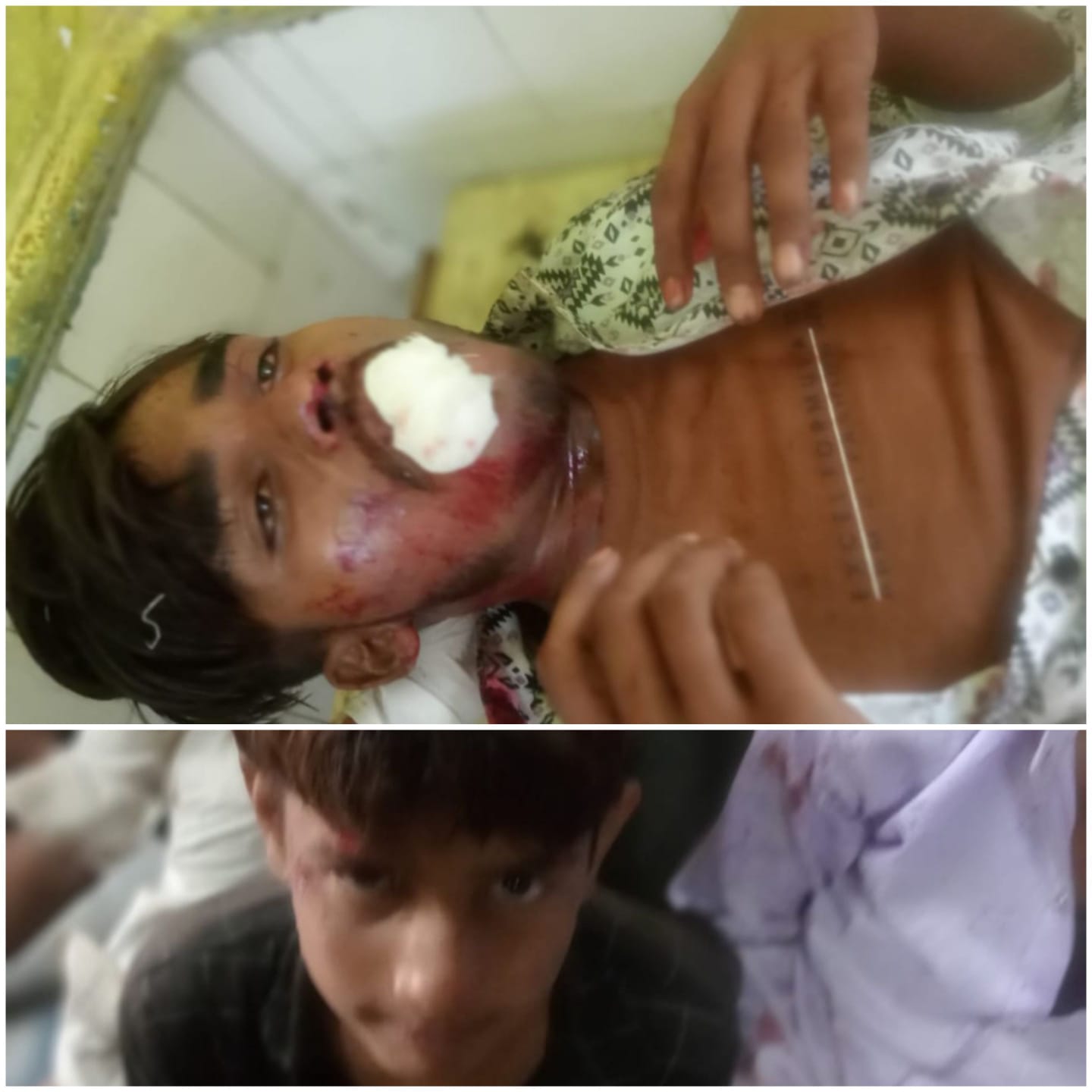 rajgarh,  speeding tractor-trolley, overturned