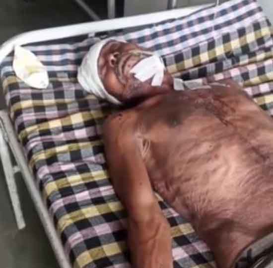 chatarpur,Middle aged man , transaction dispute