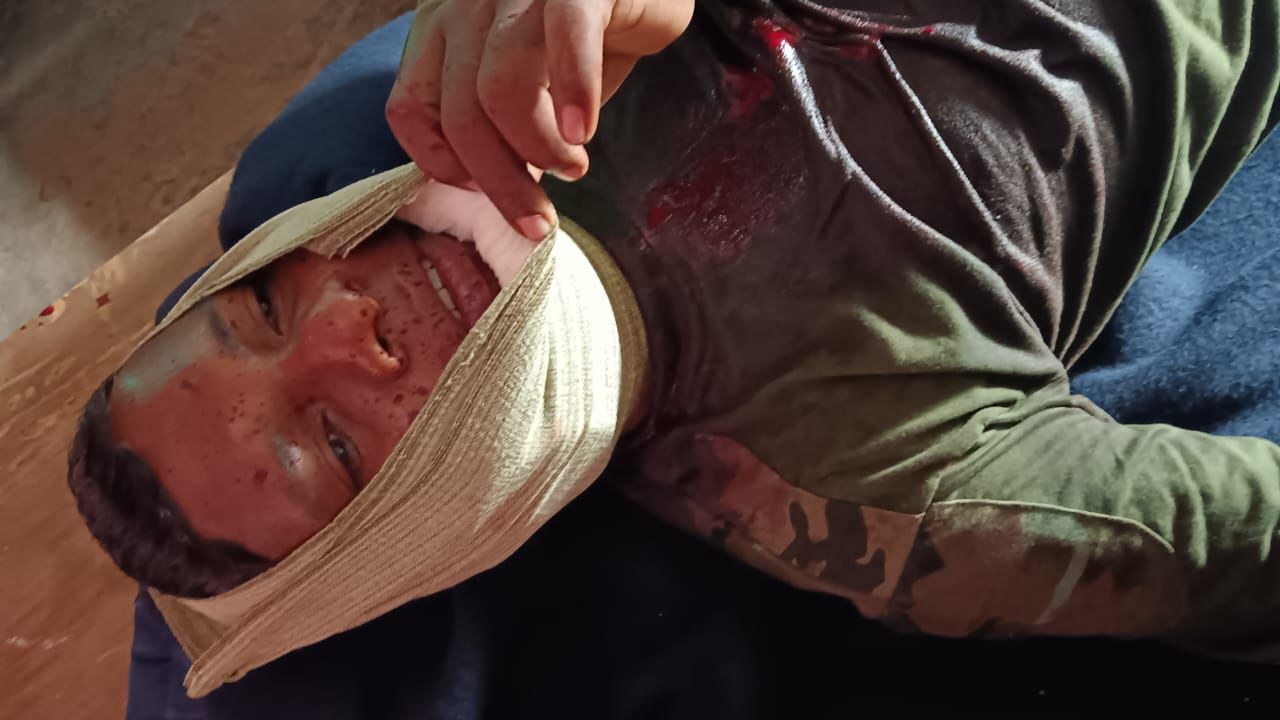 sukma, Naxalites attack, injure two soldiers  