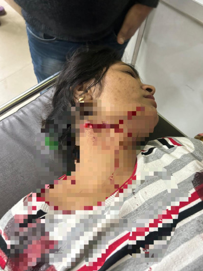 jabalpur, Women were stabbed, one died