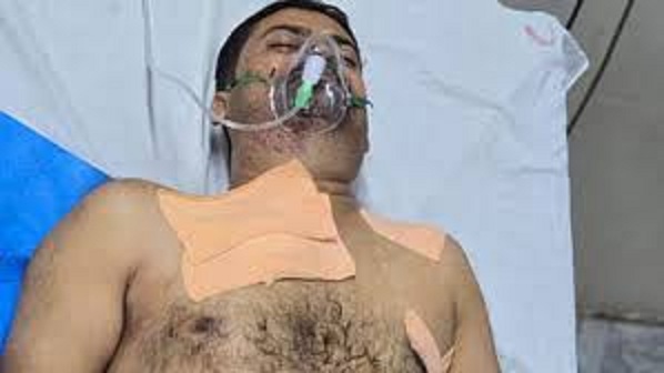 satna, Head constable injured ,dies during treatment