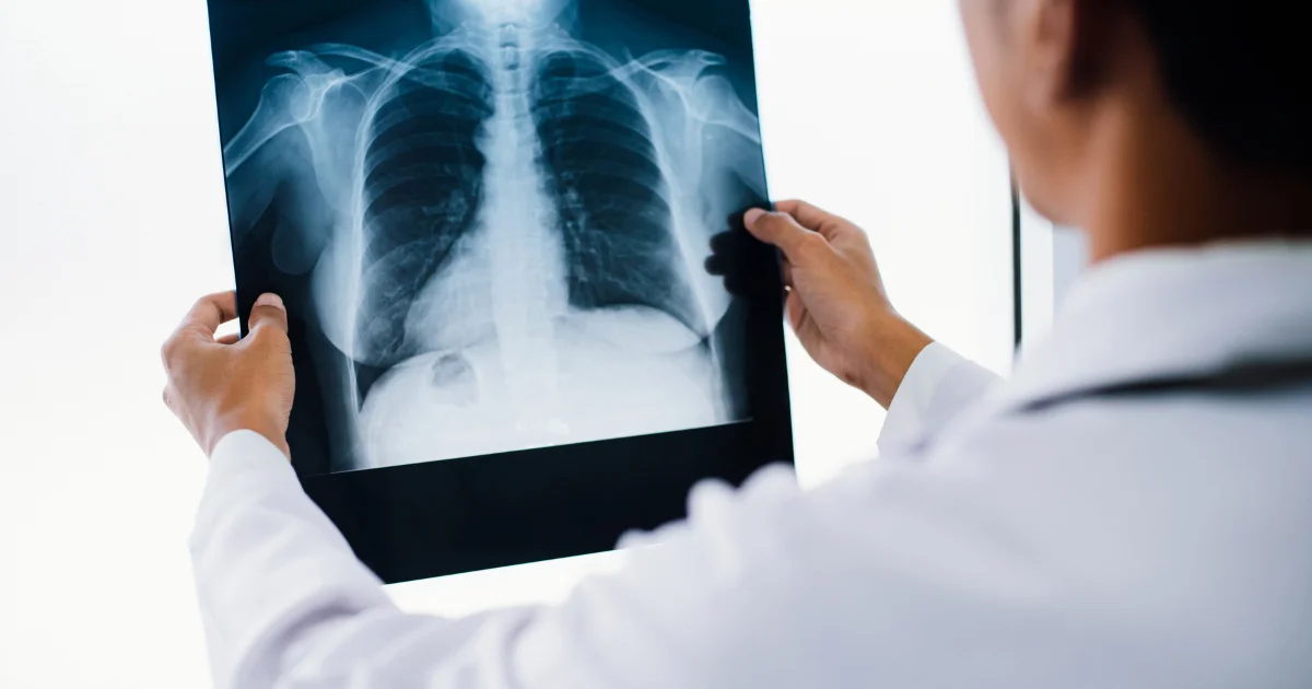 Rewa , X-ray , Super Specialty Hospital, increasing problems , patients