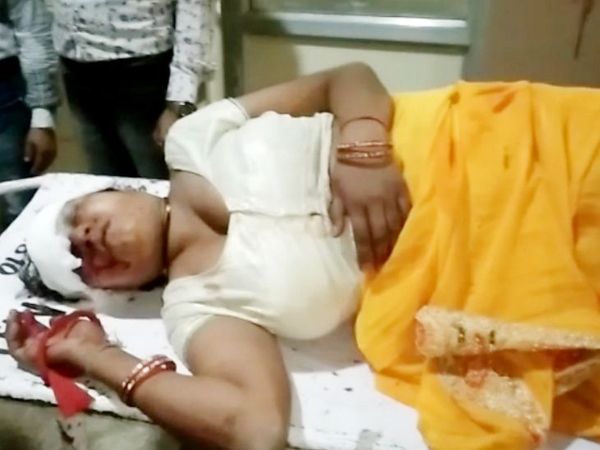 Indore, Woman jumped from the window,moving bus, injured