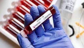 bhopal,26 new cases , corona found in MP