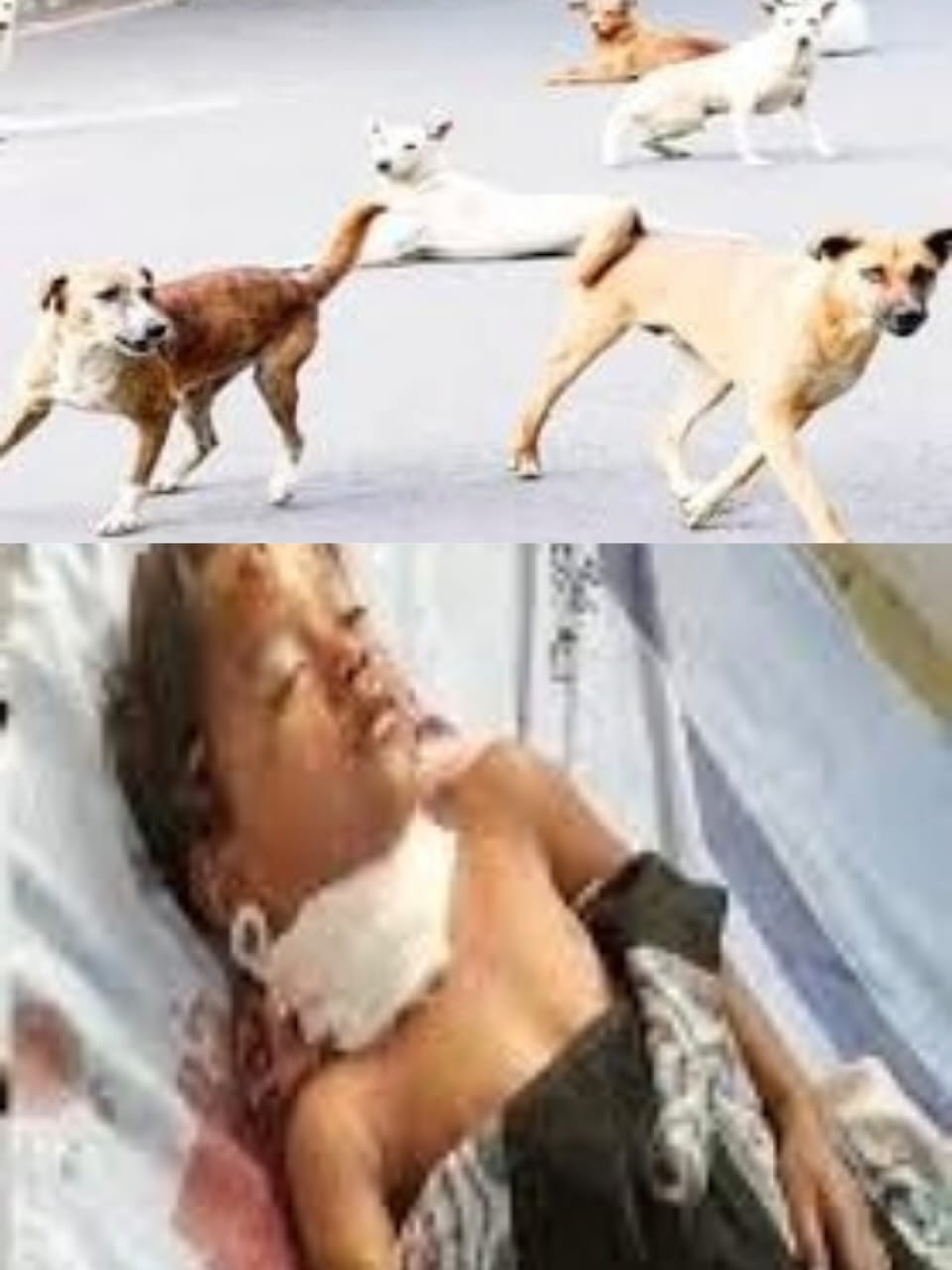 खरगोन में आवारा कुत्ते ने ली 5 साल की बच्ची की जान 