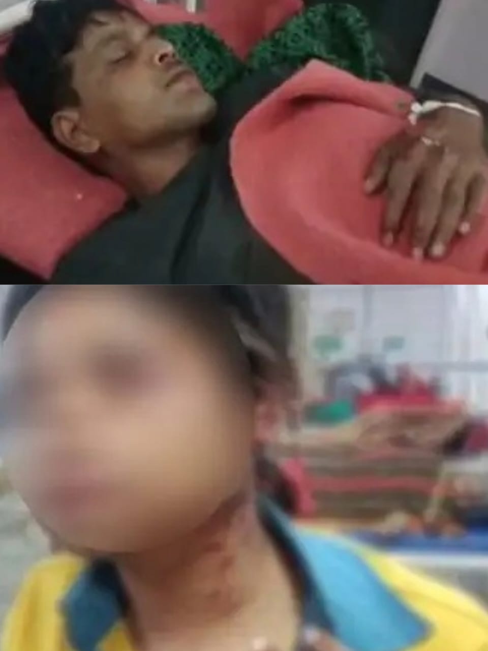 अलग होने पर लिव इन पार्टनर ने प्रेमिका से की मारपीट खिलाया ज़हर 